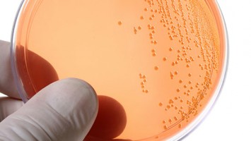 bacterial-culture-salmonella